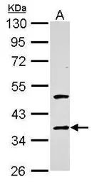 Anti-Galectin 4 antibody used in Western Blot (WB). GTX127351