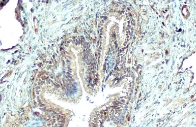 Anti-Galectin 9 antibody used in IHC (Paraffin sections) (IHC-P). GTX127353