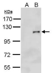 Anti-HA tag antibody (HRP) used in Western Blot (WB). GTX127376-01
