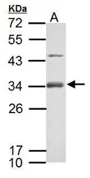 Anti-RSPO1 antibody used in Western Blot (WB). GTX127912