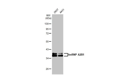 Anti-hnRNP A2B1 antibody used in Western Blot (WB). GTX127928