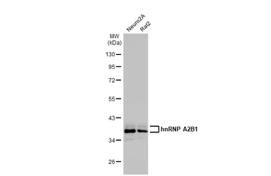 Anti-hnRNP A2B1 antibody used in Western Blot (WB). GTX127928
