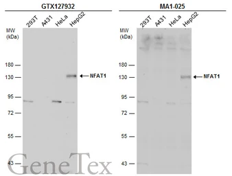 Anti-NFAT1 antibody used in Western Blot (WB). GTX127932