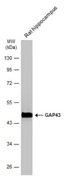 Anti-GAP43 antibody used in Western Blot (WB). GTX127937