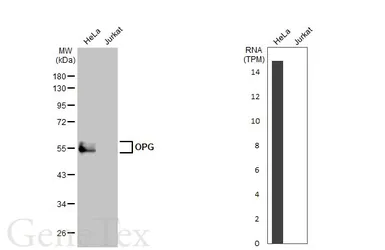 Anti-OPG antibody used in Western Blot (WB). GTX127948