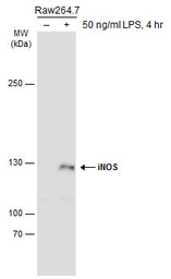 Anti-iNOS antibody used in Western Blot (WB). GTX127952