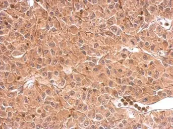 Anti-DCTD antibody used in IHC (Paraffin sections) (IHC-P). GTX127971