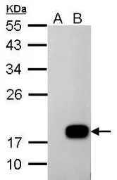 Anti-DCTD antibody used in Western Blot (WB). GTX127971