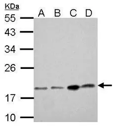 Anti-DCTD antibody used in Western Blot (WB). GTX127971
