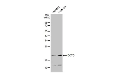 Anti-DCTD antibody used in Western Blot (WB). GTX127971