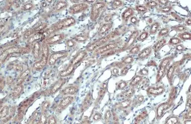Anti-DCTD antibody used in IHC (Paraffin sections) (IHC-P). GTX127971