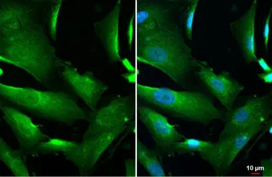 Anti-DCTD antibody used in Immunocytochemistry/ Immunofluorescence (ICC/IF). GTX127971