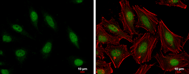 Anti-HMGB1 + HMGB2 antibody used in Immunocytochemistry/ Immunofluorescence (ICC/IF). GTX127972