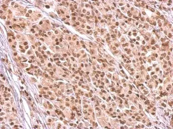 Anti-HMGB1 + HMGB2 antibody used in IHC (Paraffin sections) (IHC-P). GTX127972