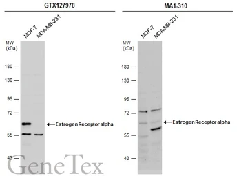 Anti-Estrogen Receptor alpha antibody used in Western Blot (WB). GTX127978