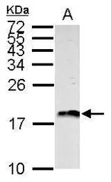 Anti-Histone H3 antibody used in Western Blot (WB). GTX127985