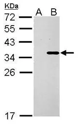 Anti-COL11A2 antibody used in Western Blot (WB). GTX128011