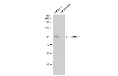 Anti-PIWIL1 antibody used in Western Blot (WB). GTX128020