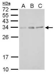 Anti-UCP4 antibody used in Western Blot (WB). GTX128022