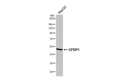 Anti-CFDP1 antibody used in Western Blot (WB). GTX128023