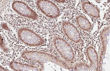 Anti-CFDP1 antibody used in IHC (Paraffin sections) (IHC-P). GTX128023
