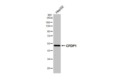 Anti-CFDP1 antibody used in Western Blot (WB). GTX128024