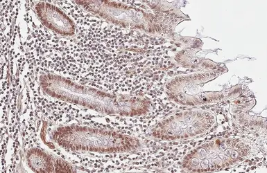 Anti-CFDP1 antibody used in IHC (Paraffin sections) (IHC-P). GTX128024