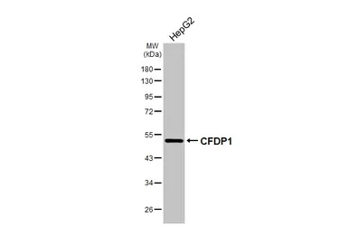 Anti-CFDP1 antibody used in Western Blot (WB). GTX128025