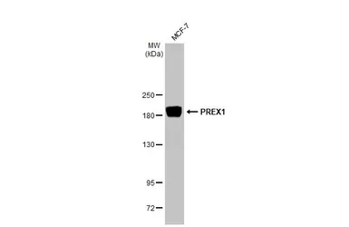 Anti-PREX1 antibody used in Western Blot (WB). GTX128037