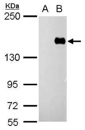 Anti-PREX1 antibody used in Western Blot (WB). GTX128037