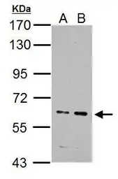 Anti-IKZF4 antibody used in Western Blot (WB). GTX128043