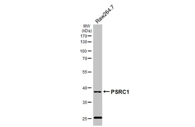 Anti-PSRC1 antibody used in Western Blot (WB). GTX128047