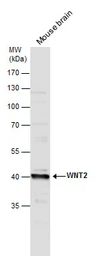 Anti-Wnt2 antibody used in Western Blot (WB). GTX128098