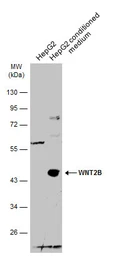 Anti-Wnt2b antibody used in Western Blot (WB). GTX128099