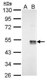Anti-Wnt7a antibody used in Western Blot (WB). GTX128106