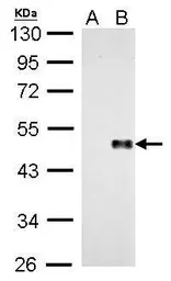 Anti-Wnt8a antibody used in Western Blot (WB). GTX128108