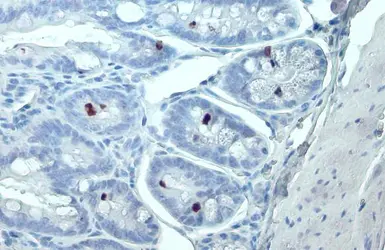 Anti-Histone H3S10ph (phospho Ser10) antibody used in IHC (Paraffin sections) (IHC-P). GTX128116