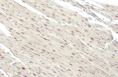 Anti-ATR (phospho Thr1989) antibody used in IHC (Paraffin sections) (IHC-P). GTX128145