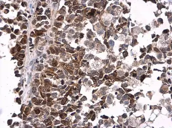 Anti-CDC2 (phospho Tyr15) antibody used in IHC (Paraffin sections) (IHC-P). GTX128155