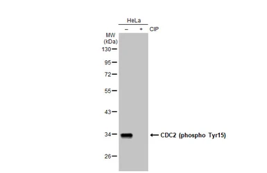 Anti-CDC2 (phospho Tyr15) antibody used in Western Blot (WB). GTX128155