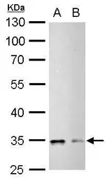 Anti-CDC2 (phospho Tyr15) antibody used in Western Blot (WB). GTX128155