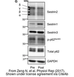 Anti-SQSTM1 / P62 (phospho Ser403) antibody used in Western Blot (WB). GTX128171