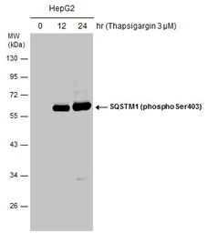 Anti-SQSTM1 / P62 (phospho Ser403) antibody used in Western Blot (WB). GTX128171