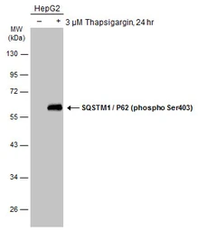 Anti-SQSTM1 / P62 (phospho Ser403) antibody used in Western Blot (WB). GTX128171