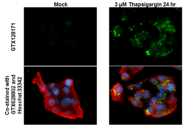 Anti-SQSTM1 / P62 (phospho Ser403) antibody used in Immunocytochemistry/ Immunofluorescence (ICC/IF). GTX128171