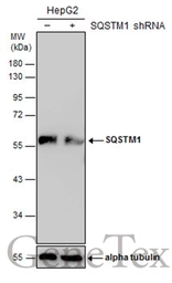 Anti-SQSTM1 / P62 antibody used in Western Blot (WB). GTX128173