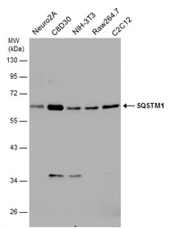 Anti-SQSTM1 / P62 antibody used in Western Blot (WB). GTX128173