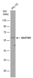 Anti-SQSTM1 / P62 antibody used in Western Blot (WB). GTX128173
