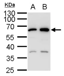 Anti-SQSTM1 / P62 antibody used in Western Blot (WB). GTX128173
