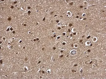 Anti-MYT1 antibody used in IHC (Paraffin sections) (IHC-P). GTX128188